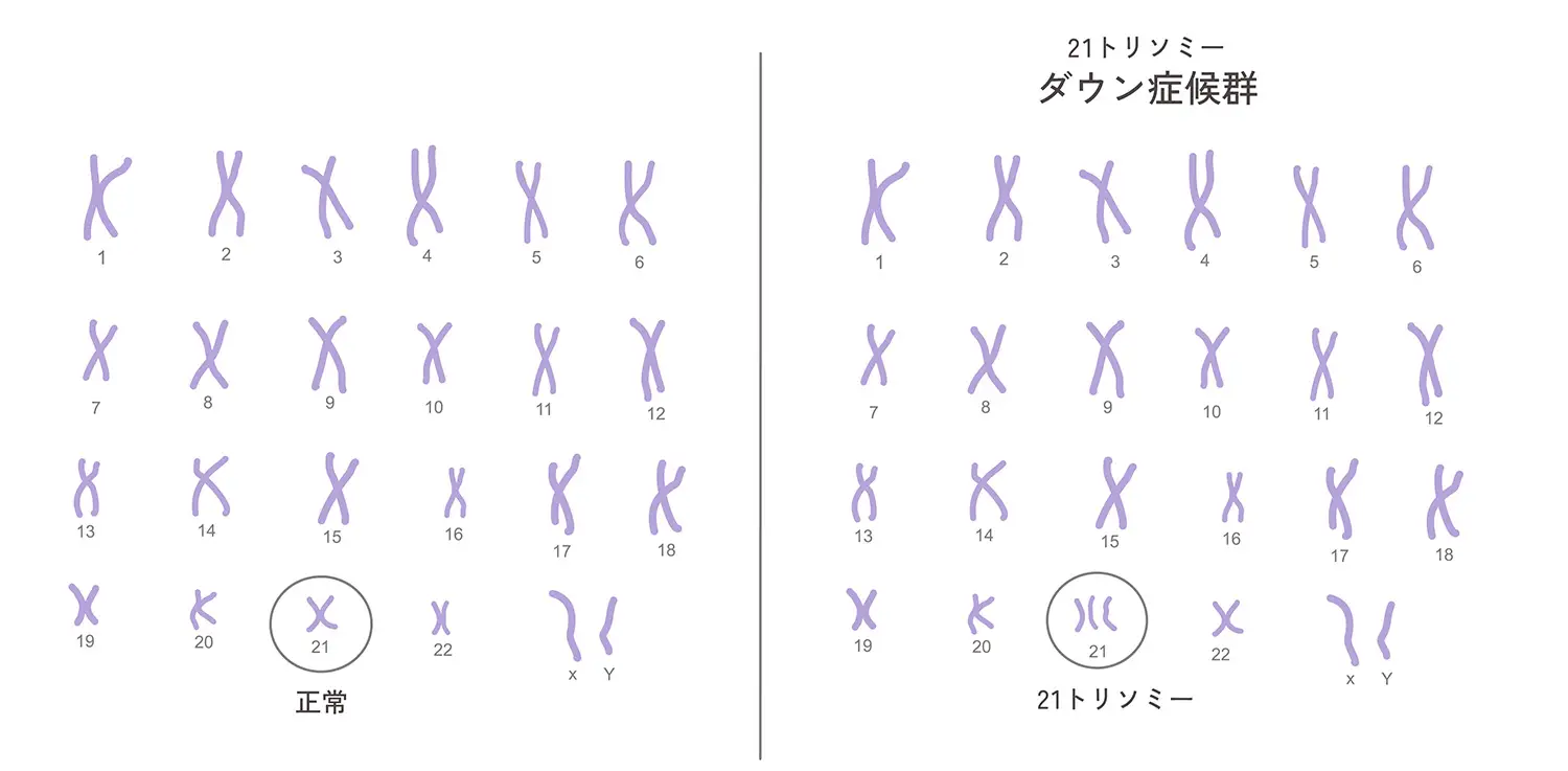 原因
