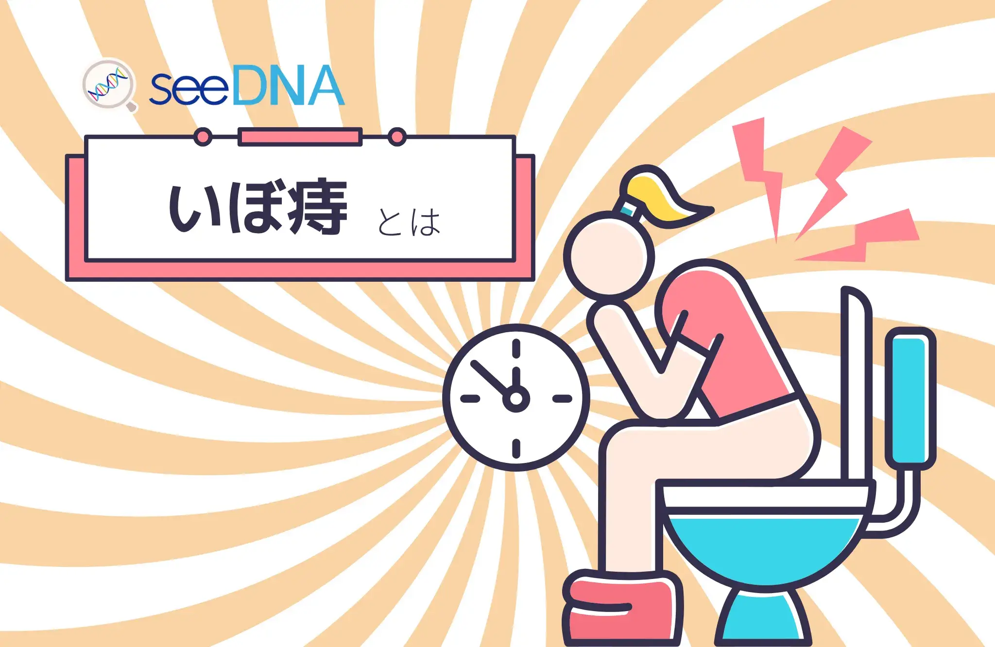 いぼ痔（痔核）のイメージ画像