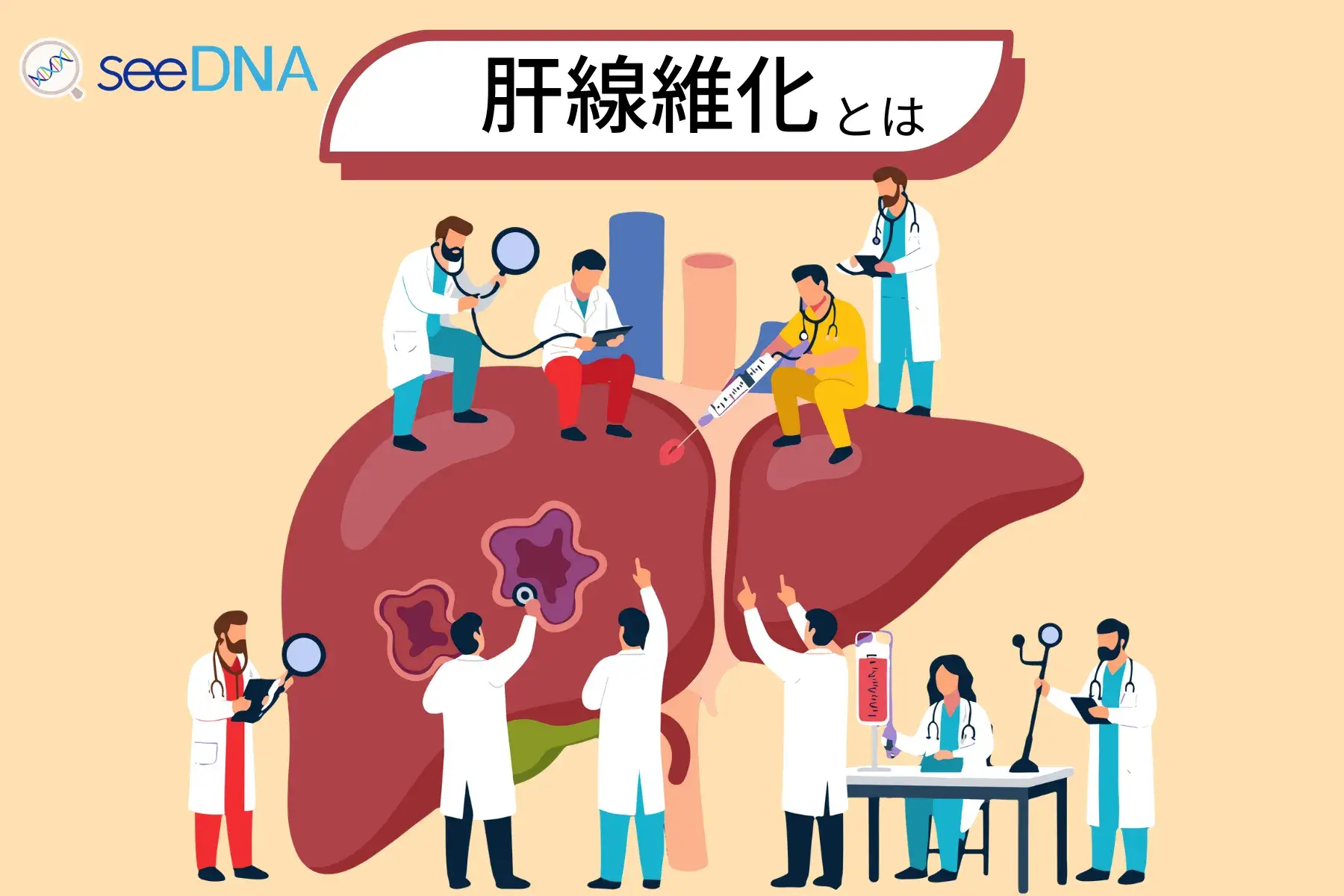肝線維化のイメージ画像