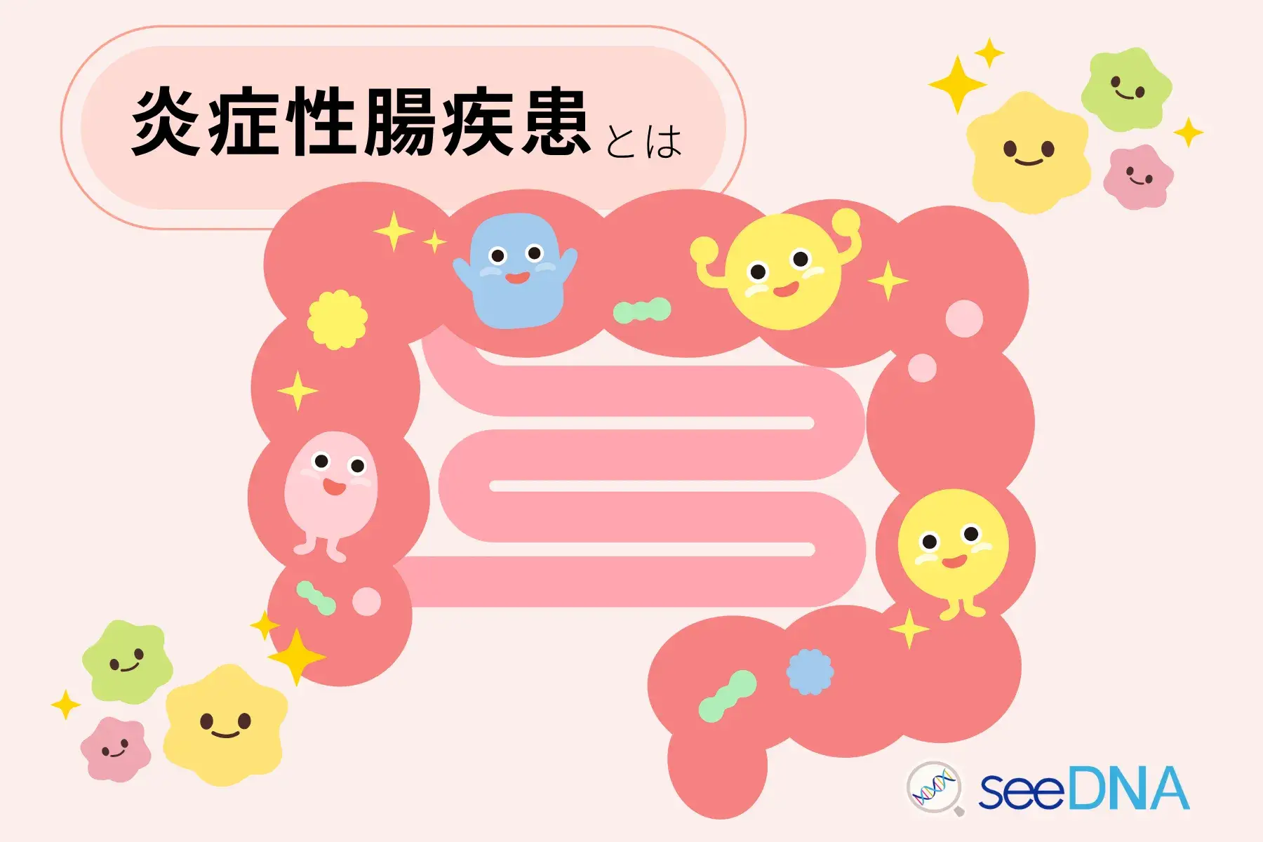 炎症性腸疾患のイメージ画像