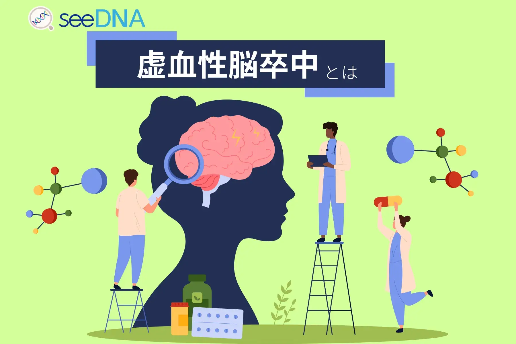 虚血性脳卒中のイメージ画像