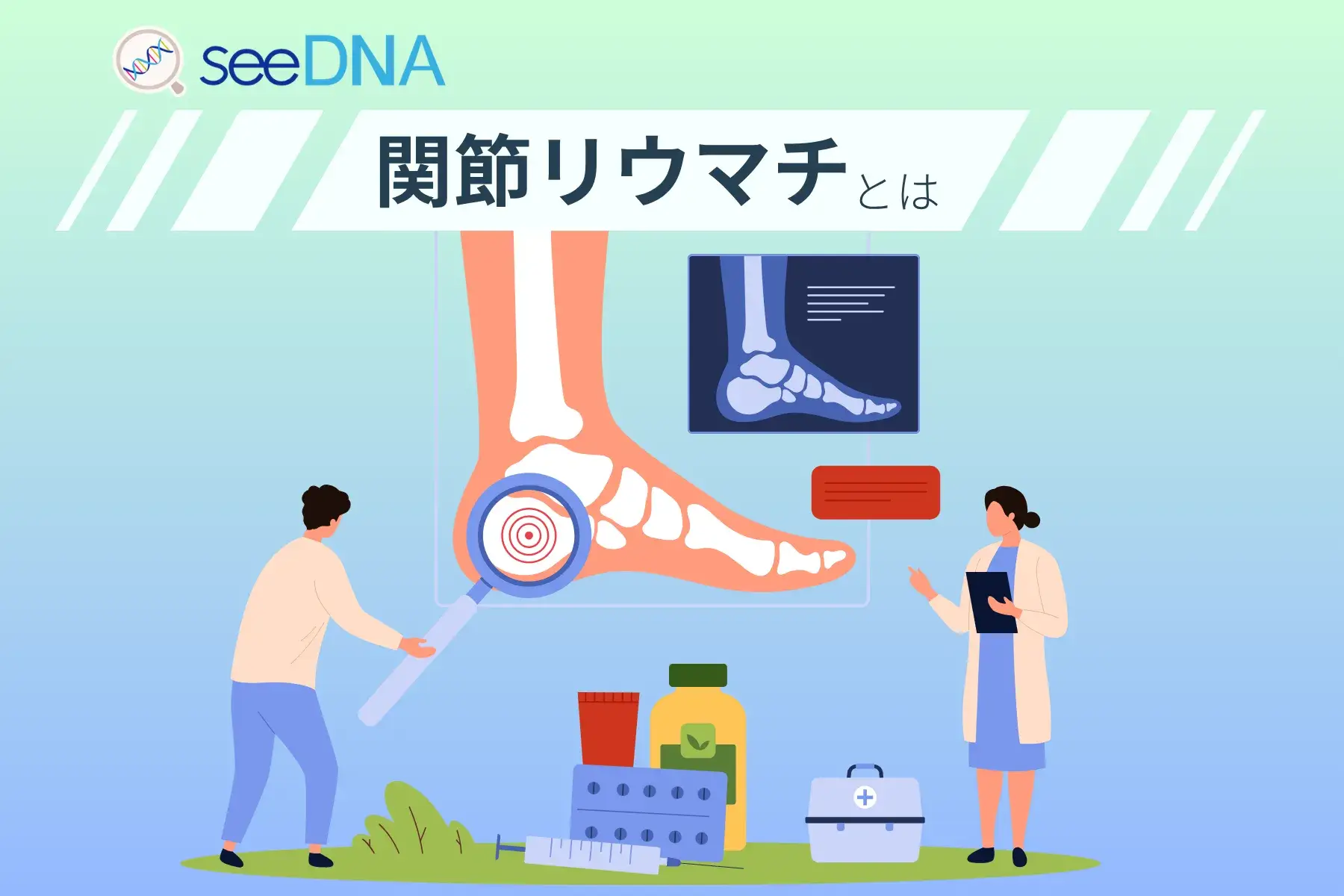 関節リウマチのイメージ画像