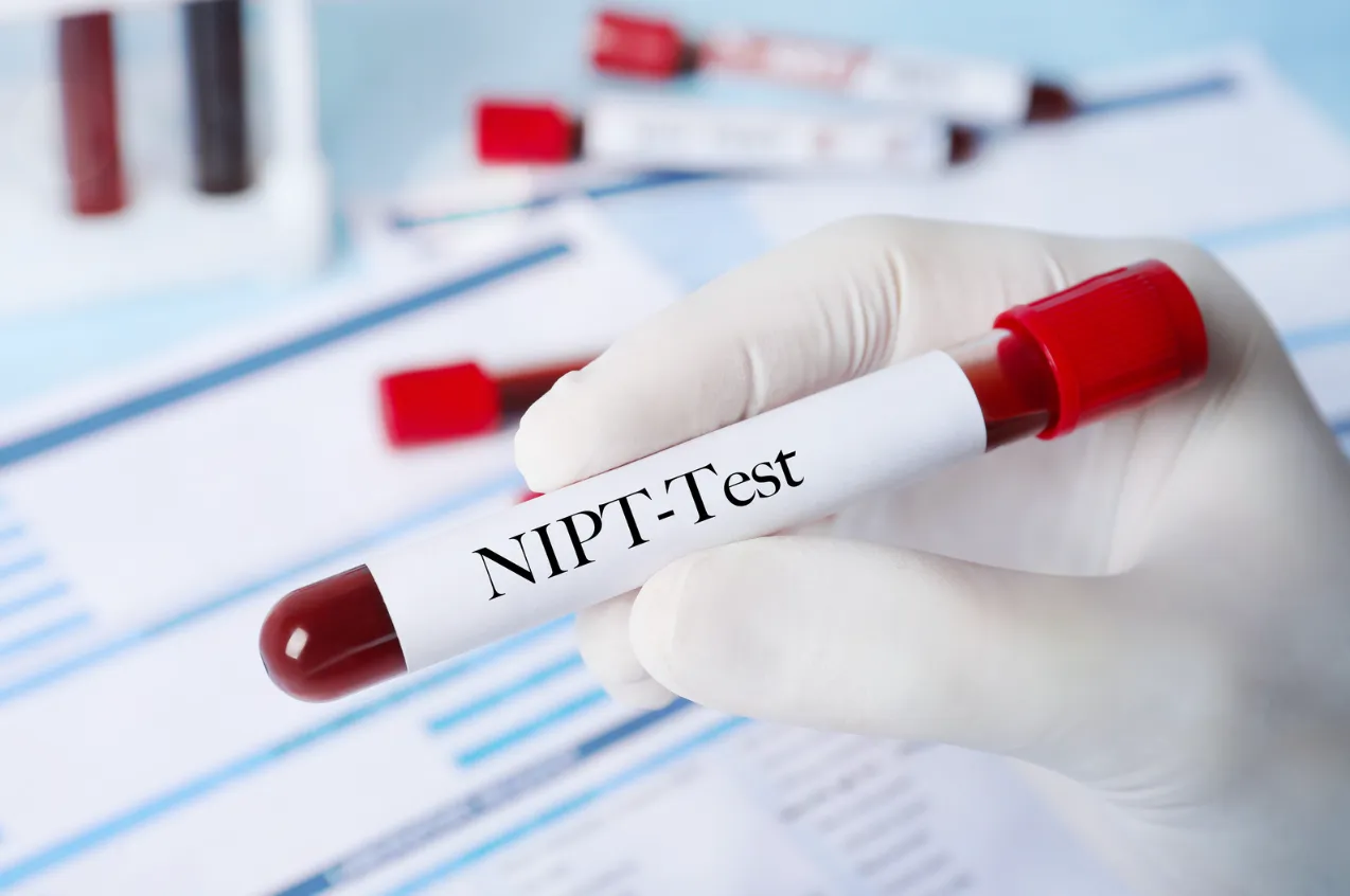 What Is NIPT? How the Test Works and Why It's Safe
